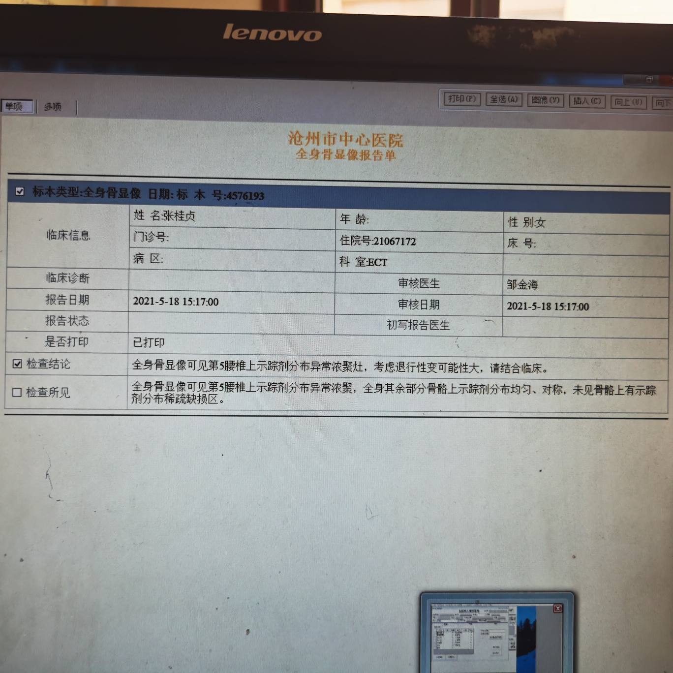 五个月易瑞沙耐药以后的检查结果出来了基因检测还要等准备化疗了