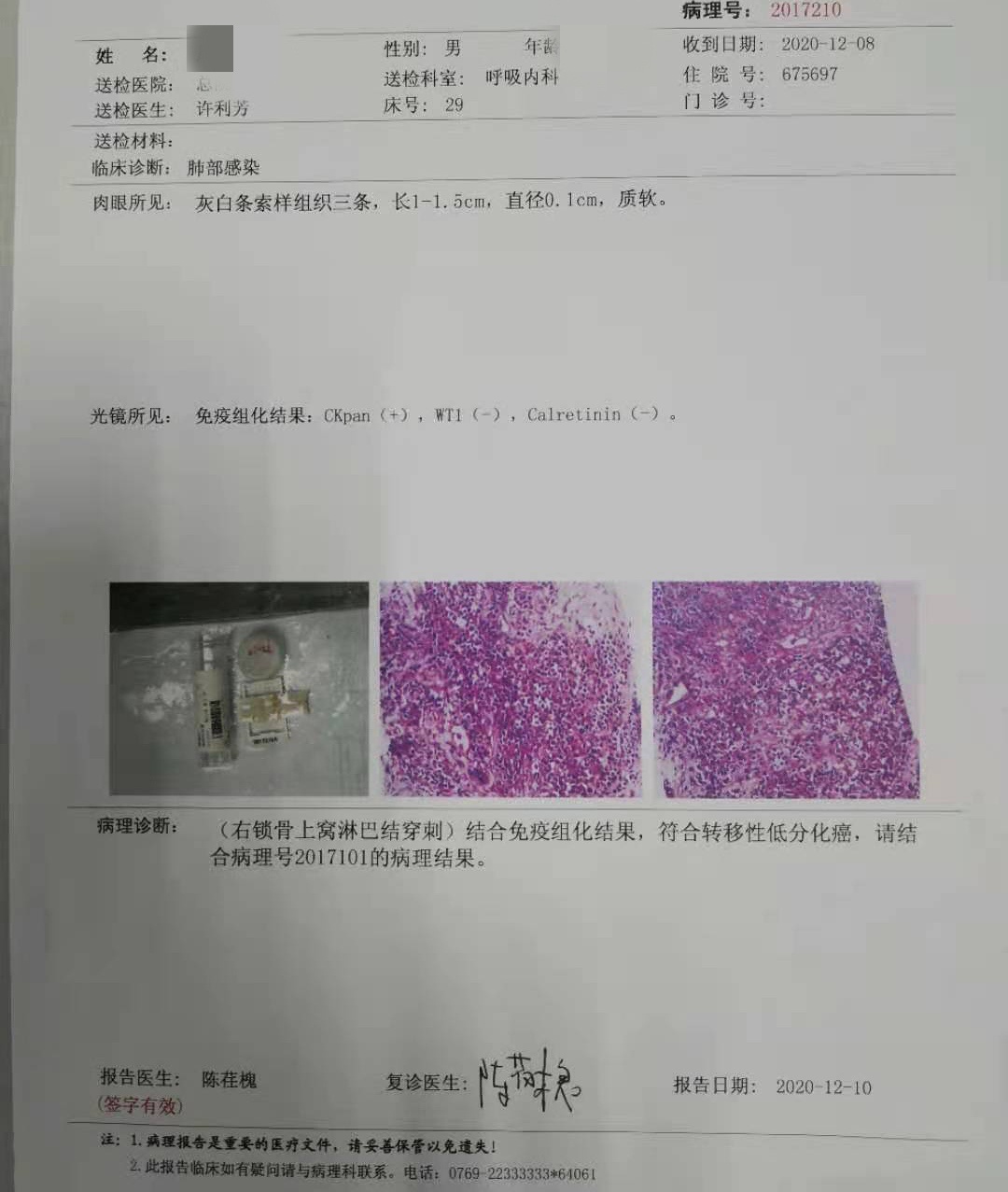 间隔10天,两次纤支镜免疫组化结果不同,与癌共舞,综合分区(含egfr突变